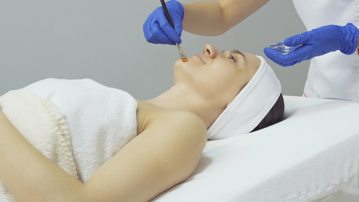 chemical peel certification course