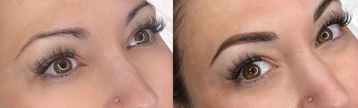micropigmentation-before and after