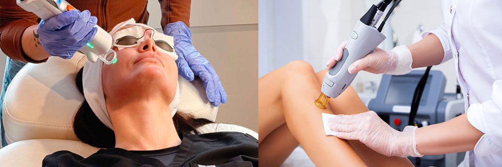 depicting laser removal from face and legs
